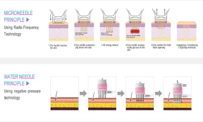 Dermashine-4 Principle introduction