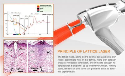 Instrument name: CO2 lattice laser